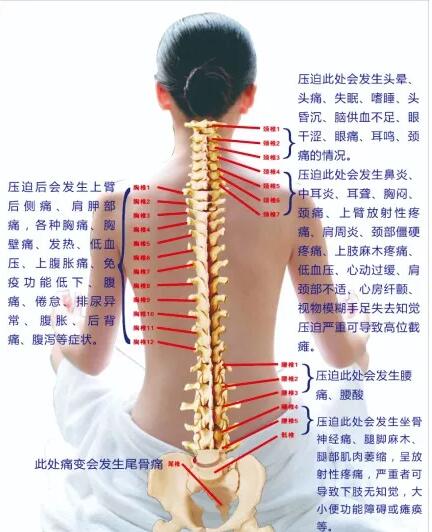 保護(hù)腰椎—示范腰椎保健操，趕快收藏吧