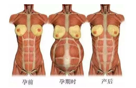 產(chǎn)后媽媽骨盆修復(fù)――帶你回到完美身材！