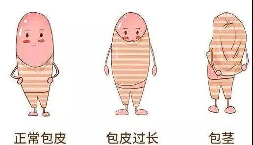 【保山安利醫(yī)院】家長(zhǎng)速看！暑期包皮手術(shù)預(yù)約正當(dāng)時(shí)！