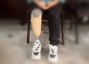 【保山安利醫(yī)院】全國助殘日我們在行動(dòng)——為51名殘疾患者行假肢維修安裝及康復(fù)指導(dǎo)服務(wù)