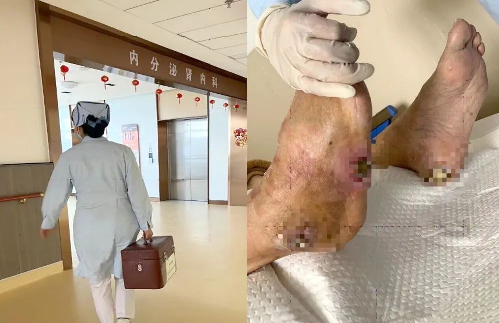 【保山安利醫(yī)院】傷口治療一站式，健康生活零距離！